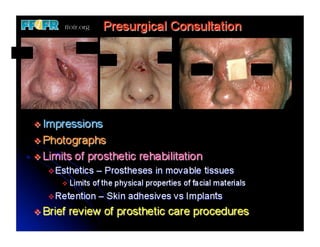 23.restoration of nasal defects | PDF