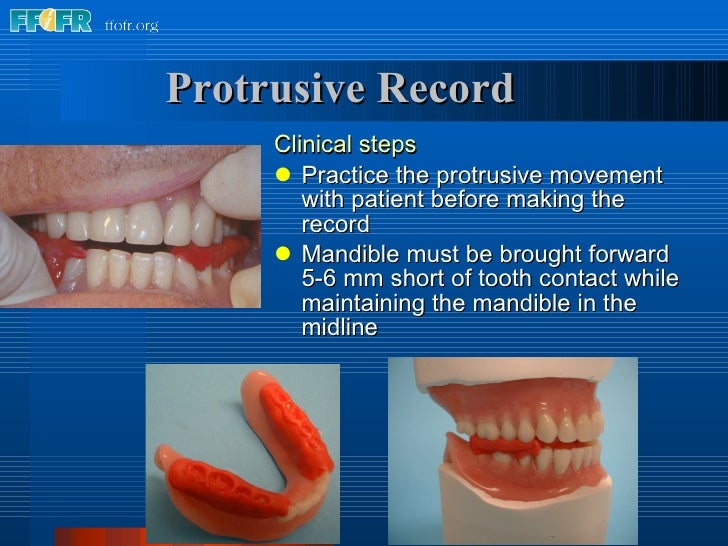 23.trial denture appointment