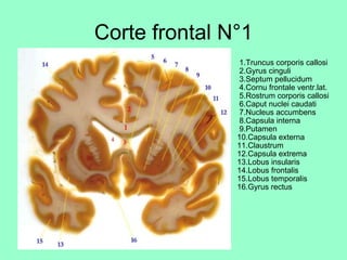 Corte frontal N°1 ,[object Object]