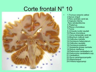 Corte frontal N° 10   1.Truncus corporis callosi  2.Gyrus cinguli  3.Pars centralis ventr.lat.  4.Capsula interna   Pars retrolentiformis  5.Thalamus  6.Plexus choroideus  7.Fornix  8.,9.Cauda nuclei caudati 10.Plexus choroideus 11.Cornu temporale ventr.lat. 12.Brachium colliculi rostr. 13.Colliculus rostralis 14.Comissura habenularum 15.Colliculus caudalis 16.Comissura posterior 17.Substantia grisea centralis 18.Sulcus medianus 19.Pedunculus cerebellaris inf. 20.Pedunculus cerebellaris sup. 21.Cerebellum 22.Gyrus parahippocampalis 23.Hippocampus 24.Fimbria hippocampi 