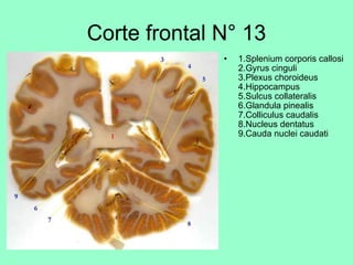 Corte frontal N° 13   1.Splenium corporis callosi  2.Gyrus cinguli  3.Plexus choroideus  4.Hippocampus  5.Sulcus collateralis  6.Glandula pinealis  7.Colliculus caudalis  8.Nucleus dentatus  9.Cauda nuclei caudati 