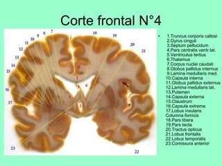 Corte frontal N°4   1.Truncus corporis callosi  2.Gyrus cinguli  3.Septum pellucidum  4.Pars centralis ventr.lat.  5.Ventriculus tertius  6.Thalamus  7.Corpus nuclei caudati  8.Globus pallidus internus  9.Lamina medullaris med. 10.Capsula interna 11.Globus pallidus externus 12.Lamina medullaris lat. 13.Putamen 14.Capsula externa 15.Claustrum 16.Capsula extrema 17.Lobus insularis  Columna fornicis 18.Pars libera 19.Pars tecta   20.Tractus opticus 21.Lobus frontalis 22.Lobus temporalis 23.Comissura anterior 