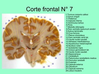 Corte frontal N° 7 1.Truncus corporis callosi  2.Gyrus cinguli  3.Thalamus  4.Capsula interna  5.Ventriculus tertius  6.Pons  7.Medulla oblongata  8.Pars ventralis padunculi cerebri  9.Sulcus terminalis 10.Crus fornicis 11.Plexus choroideus 12.Pars centralis ventr.lat. 13.Cauda nuclei caudati 14.Adhaesio interthalamica 15.Aqueductus mesencephali 16.Nucleus ruber 17.Substantia nigra 18.Corpus geniculatum lat. 19.Cauda nuclei caudati 20.Hippocampus 21.Cerebellum 22.Pedunculus cerebellaris medius 23.Flocculus cerebelli 24.Putamen 25.Capsula externa 26.Claustrum 27.Capsula extrema 28.Lobus insularis 