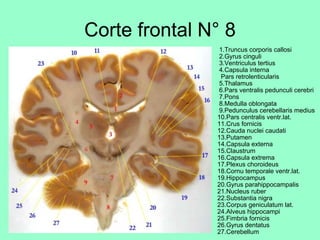 Corte frontal N° 8   1.Truncus corporis callosi  2.Gyrus cinguli  3.Ventriculus tertius  4.Capsula interna   Pars retrolenticularis  5.Thalamus  6.Pars ventralis pedunculi cerebri  7.Pons  8.Medulla oblongata  9.Pedunculus cerebellaris medius 10.Pars centralis ventr.lat. 11.Crus fornicis 12.Cauda nuclei caudati 13.Putamen 14.Capsula externa 15.Claustrum 16.Capsula extrema 17.Plexus choroideus 18.Cornu temporale ventr.lat. 19.Hippocampus 20.Gyrus parahippocampalis 21.Nucleus ruber 22.Substantia nigra 23.Corpus geniculatum lat. 24.Alveus hippocampi 25.Fimbria fornicis 26.Gyrus dentatus 27.Cerebellum 
