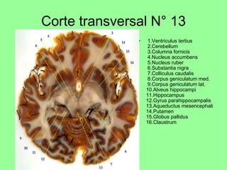 corte transversal de encefalo | PPT