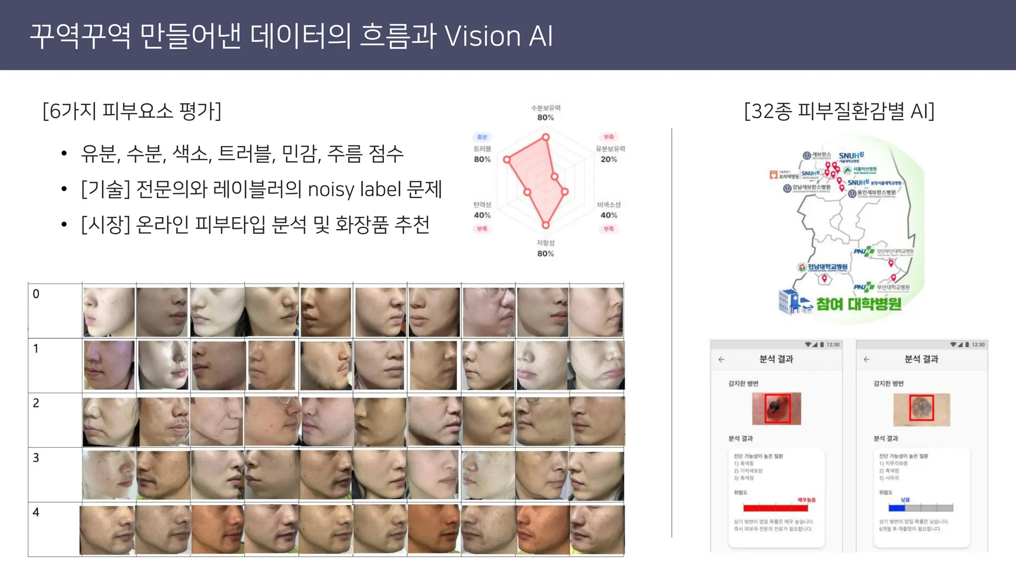 꾸역꾸역 만들어낸 데이터의 흐름과 Vision AI
[32종 피부질환감별 AI]
[6가지 피부요소 평가]
• 유분, 수분, 색소, 트러블, 민감, 주름 점수
• [기술] 전문의와 레이블러의 noisy label 문제
• [시장] 온라인 피부타입 분석 및 화장품 추천
 
