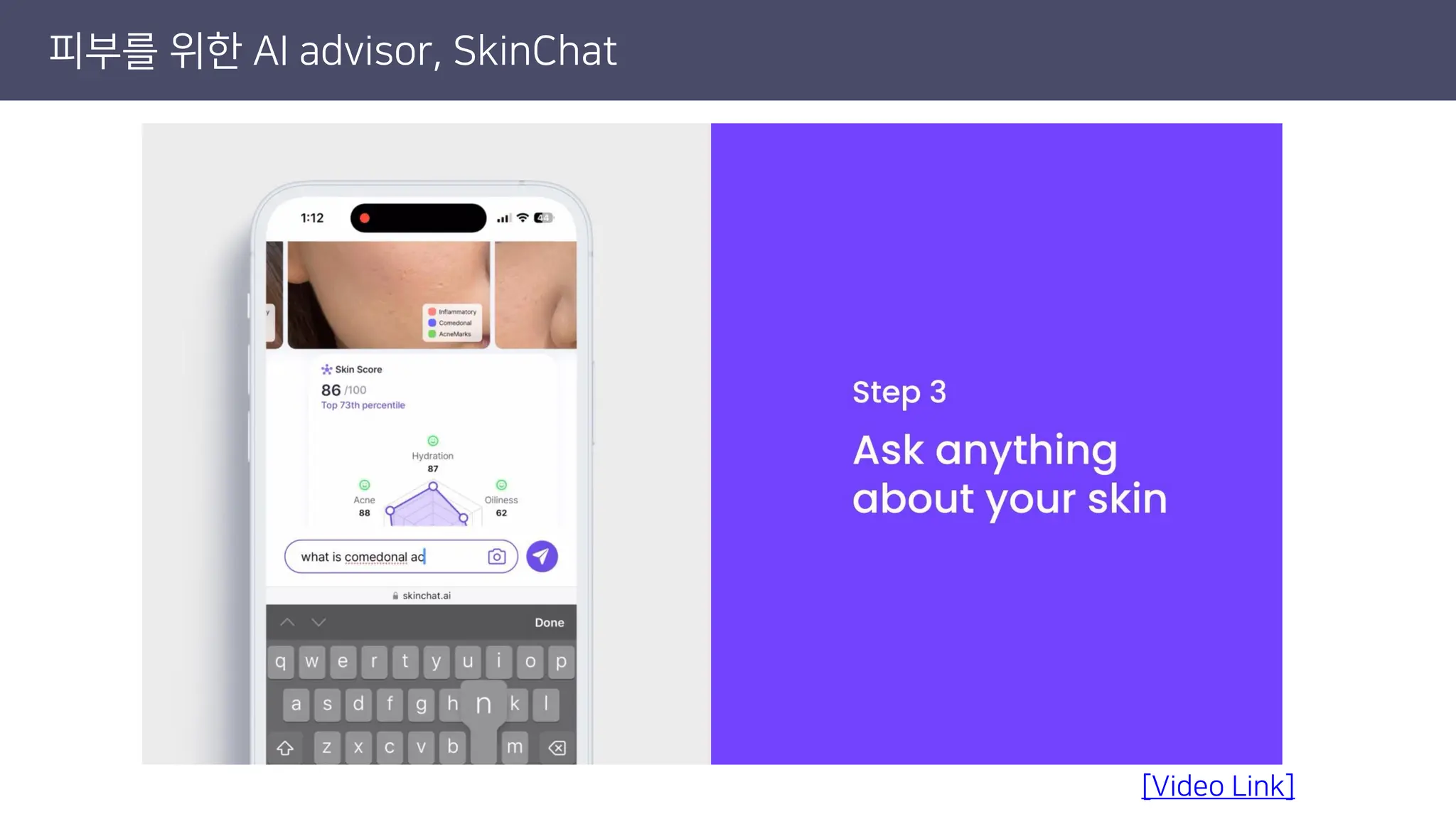 피부를 위한 AI advisor, SkinChat
[Video Link]
 