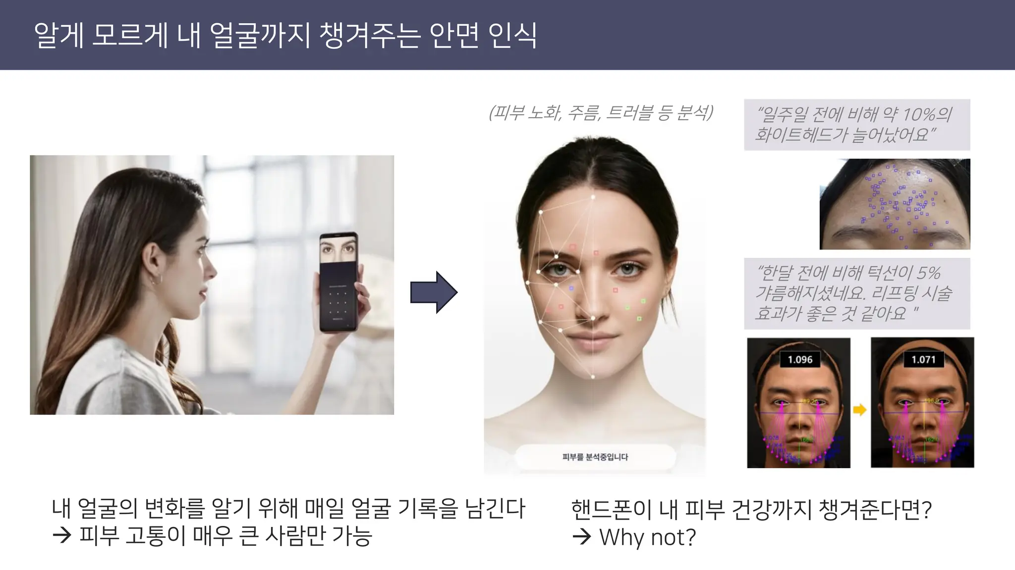 알게 모르게 내 얼굴까지 챙겨주는 안면 인식
내 얼굴의 변화를 알기 위해 매일 얼굴 기록을 남긴다
→ 피부 고통이 매우 큰 사람만 가능
핸드폰이 내 피부 건강까지 챙겨준다면?
→ Why not?
“일주일 전에 비해 약 10%의
화이트헤드가 늘어났어요”
“한달 전에 비해 턱선이 5%
갸름해지셨네요. 리프팅 시술
효과가 좋은 것 같아요＂
(피부 노화, 주름, 트러블 등 분석)
 