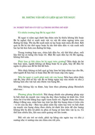 III. NHÛÄNG VÊËN ÀÏÌ COÁ LIÏN QUAN TÚÁI NGÛÅC
38. NGHEÅT THÚÃ DO COÁ VÊÅT LAÅ TRONG ÀÛÚÂNG HÖ HÊËP
Coá nhiïìu trûúâng húåp Beá bõ ngaåt thúã:
Bi ngaåt vò nùçm nguã dûúái lúáp chùn nïn bõ thiïëu khöng khñ hoùåc
Beá bõ ngheåt thúã vò nuöët möåt vêåt vaâ vêåt àoá nùçm ngaáng trïn con
àûúâng hö hêëp. Thñ duå Beá nuöët möåt cuã laåc hoùåc möåt mêíu àöì chúi. Kïët
quaã laâ Beá bõ tùæc thúã ngay hoùåc bõ tùæc thúã dêìn dêìn vò vêåt nuöët möîi
luác laåi bõt kñn hún con àûúâng hö hêëp.
Trong trûúâng húåp sau, chaáu bùæt àêìu ho, röìi thúã khoá nhoåc, möîi
lêìn thúã laåi coá tiïëng rïn hoùåc rñt. Mùåt Beá saåm dêìn laåi röìi Beá ngûng,
khöng thúã nûäa.
Phaãi laâm gò khi chaáu beá bõ ngaåt trïn giûúâng? Nïëu thêëy da beá
tñm hay xaám, ngûúâi khöng cûã àöång hoùåc bõ co giêåt, haäy àïí àêìu beá
ngûãa ra phña sau àïí beá thúã dïî hún.
Nïëu thêëy khöng coá kïët quaã gò haäy laâm hö hêëp nhên taåo cho Beá,
nhúâ ngûúâi ài baáo baác sô hoùåc àûa Beá túái traåm cêëp cûáu ngay.
Nïëu beá ngaåt vò nuöët phaãi möåt vêåt vaâo hoång: Nïëu baån nhòn thêëy
vêåt àoá, haäy thûã cöë lêëy vêåt àoá ra bùçng ngoán tay cuãa mònh vaâ chuá yá
khöng laâm cho vêåt tuåt sêu thïm vaâo hoång Beá .
Nïëu khöng lêëy ra àûúåc, haäy laâm theo phûúng phaáp Heimlich
nhû sau :
Phûúng phaáp Heimlich: Nöåi dung chñnh cuãa phûúng phaáp naây
laâ bêët chúåt êën maånh vaâo vuâng daå daây theo hûúáng tûâ dûúái lïn. Giûä
chaáu beá úã tû thïë àûáng hay ngöìi (xem hònh veä). Ngûúâi chûäa cho chaáu
àûáng úã àùçng sau, nùæm baân tay traái laåi àùåt lïn buång chaáu úã trïn röën
- võ trñ cuãa daå daây - Baân tay phaãi nùæm lêëy nùæm tay traái vaâ bêët chúåt
eáp maånh vaâo buång chaáu theo chiïìu tûâ dûúái lïn trïn àïí cho lûúång
khöng khñ bõ döìn tûâ phöíi ra phña cöí hoång seä laâm bùæn vêåt laå ra. Coá
thïí laâm nhiïìu lêìn, lêìn sau caách quaäng vúái lêìn trûúác.
Àöëi vúái caác treã sú sinh, phaãi eáp bùçng caác ngoán tay vaâ chuá yá
nûúng nheå vò xûúng cuãa caác chaáu coân rêët yïëu.
 