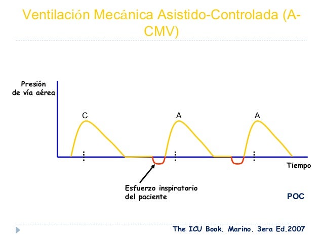 GENERALIDADES DE VENTILACIÓN MECÁNICA