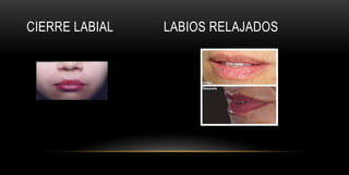 Labio Reposo Manual-de-Fotografia-Clinica-Para-El-Odontologo.pptx