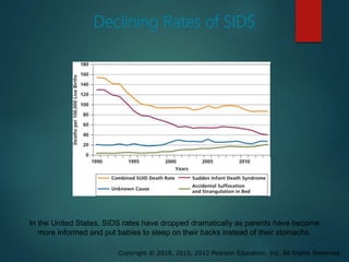 Copyright © 2018, 2015, 2012 Pearson Education, Inc. All Rights Reserved
Declining Rates of SIDS
In the United States, SIDS rates have dropped dramatically as parents have become
more informed and put babies to sleep on their backs instead of their stomachs.
 