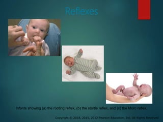 Copyright © 2018, 2015, 2012 Pearson Education, Inc. All Rights Reserved
Reflexes
Infants showing (a) the rooting reflex, (b) the startle reflex, and (c) the Moro reflex.
 