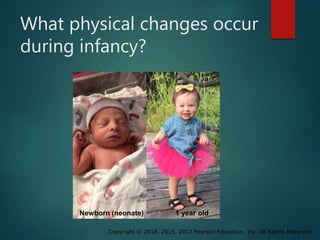 Copyright © 2018, 2015, 2012 Pearson Education, Inc. All Rights Reserved
What physical changes occur
during infancy?
Newborn (neonate) 1 year old
 