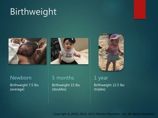 Copyright © 2018, 2015, 2012 Pearson Education, Inc. All Rights Reserved
Birthweight
Newborn
Birthweight 7.5 lbs
(average)
5 months
Birthweight 15 lbs
(doubles)
1 year
Birthweight 22.5 lbs
(triples)
 