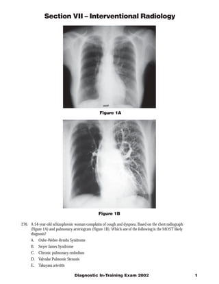 Section VII – Interventional Radiology




                                                Figure 1A




                                                Figure 1B

276. A 54-year-old schizophrenic woman complains of cough and dyspnea. Based on the chest radiograph
     (Figure 1A) and pulmonary arteriogram (Figure 1B), Which one of the following is the MOST likely
     diagnosis?
      A. Osler-Weber-Rendu Syndrome
      B.   Swyer James Syndrome
      C. Chronic pulmonary embolism
      D. Valvular Pulmonic Stenosis
      E.   Takayasu arteritis

                                  Diagnostic In-Training Exam 2002                                      1
 