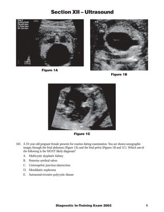 Section XII – Ultrasound




                    Figure 1A
                                                                             Figure 1B




                                                 Figure 1C


501. A 22-year-old pregnant female presents for routine dating examination. You are shown sonographic
     images through the fetal abdomen (Figure 1A) and the fetal pelvis (Figures 1B and 1C). Which one of
     the following is the MOST likely diagnosis?
     A. Multicystic dysplastic kidney
     B. Posterior urethral valves
     C. Ureteropelvic junction obstruction
     D. Mesoblastic nephroma
     E. Autosomal recessive polycystic disease




                                Diagnostic In-Training Exam 2002                                           1
 