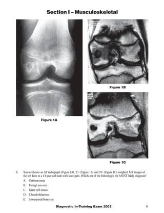 Section I – Musculoskeletal




                                                                                Figure 1B




                    Figure 1A




                                                                                Figure 1C


6.   You are shown an AP radiograph (Figure 1A), T1- (Figure 1B) and T2- (Figure 1C) weighted MR images of
     the left knee in a 14-year-old male with knee pain. Which one of the following is the MOST likely diagnosis?
     A. Osteosarcoma
     B.   Ewing’s sarcoma
     C. Giant cell tumor
     D. Chondroblastoma
     E.   Aneurysmal bone cyst

                                 Diagnostic In-Training Exam 2002                                               1
 