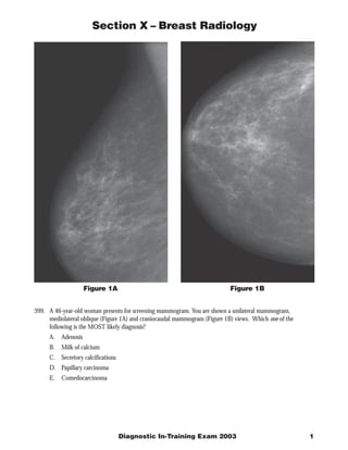 Section X – Breast Radiology




                                                                           Figure 1B
                   Figure 1A


399. A 46-year-old woman presents for screening mammogram. You are shown a unilateral mammogram,
     mediolateral oblique (Figure 1A) and craniocaudal mammogram (Figure 1B) views. Which one of the
     following is the MOST likely diagnosis?
     A. Adenosis
     B.   Milk of calcium
     C. Secretory calcifications
     D. Papillary carcinoma
     E.   Comedocarcinoma




                                   Diagnostic In-Training Exam 2003                                    1
 