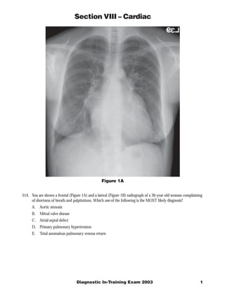 Section VIII – Cardiac




                                                 Figure 1A


314. You are shown a frontal (Figure 1A) and a lateral (Figure 1B) radiograph of a 36-year-old woman complaining
     of shortness of breath and palpitations. Which one of the following is the MOST likely diagnosis?
      A. Aortic stenosis
      B.   Mitral valve disease
      C. Atrial septal defect
      D. Primary pulmonary hypertension
      E.   Total anomalous pulmonary venous return




                                  Diagnostic In-Training Exam 2003                                            1
 