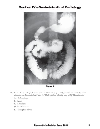 Section IV – Gastrointestinal Radiology




                                                 Figure 1


135. You are shown a radiograph from a small bowel follow-through in a 40-year-old woman with abdominal
     distension and chronic diarrhea (Figure 1). Which one of the following is the MOST likely diagnosis?
      A. Crohn’s disease
      B.   Sprue
      C. Scleroderma
      D. Giardia infection
      E.   Eosinophilic enteritis




                                    Diagnostic In-Training Exam 2003                                        1
 