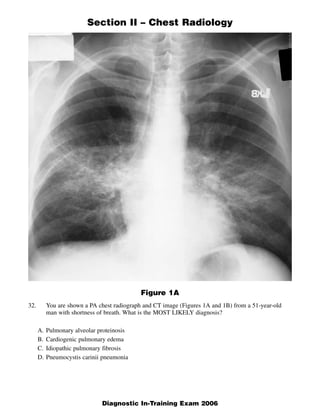 Section II – Chest Radiology




                                              Figure 1A
32.        You are shown a PA chest radiograph and CT image (Figures 1A and 1B) from a 51-year-old
           man with shortness of breath. What is the MOST LIKELY diagnosis?

      A.   Pulmonary alveolar proteinosis
      B.   Cardiogenic pulmonary edema
      C.   Idiopathic pulmonary fibrosis
      D.   Pneumocystis carinii pneumonia




                                                                                                     1
                               Diagnostic In-Training Exam 2006
 