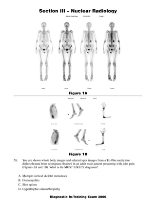 Section III – Nuclear Radiology




                                                   Figure 1A




                                                   Figure 1B
58.        You are shown whole body images and selected spot images from a Tc-99m methylene
           diphosphonate bone scintigram obtained in an adult male patient presenting with joint pain
           (Figures 1A and 1B). What is the MOST LIKELY diagnosis?

      A.   Multiple cortical skeletal metastases
      B.   Osteomyelitis
      C.   Shin splints
      D.   Hypertrophic osteoarthropathy

                                                                                                        1
                                 Diagnostic In-Training Exam 2006
 