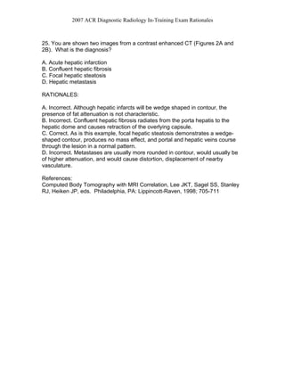 2007 ACR Diagnostic Radiology In-Training Exam Rationales
25. You are shown two images from a contrast enhanced CT (Figures 2A and
2B). What is the diagnosis?
A. Acute hepatic infarction
B. Confluent hepatic fibrosis
C. Focal hepatic steatosis
D. Hepatic metastasis
RATIONALES:
A. Incorrect. Although hepatic infarcts will be wedge shaped in contour, the
presence of fat attenuation is not characteristic.
B. Incorrect. Confluent hepatic fibrosis radiates from the porta hepatis to the
hepatic dome and causes retraction of the overlying capsule.
C. Correct. As is this example, focal hepatic steatosis demonstrates a wedge-
shaped contour, produces no mass effect, and portal and hepatic veins course
through the lesion in a normal pattern.
D. Incorrect. Metastases are usually more rounded in contour, would usually be
of higher attenuation, and would cause distortion, displacement of nearby
vasculature.
References:
Computed Body Tomography with MRI Correlation, Lee JKT, Sagel SS, Stanley
RJ, Heiken JP, eds. Philadelphia, PA: Lippincott-Raven, 1998; 705-711
 