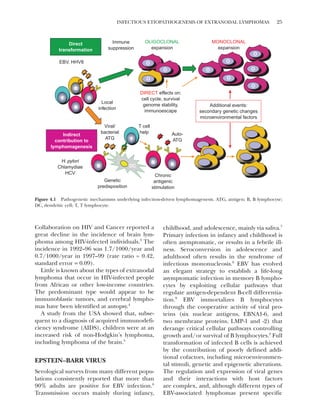 Extranodal Lymphomas Pathology And Management Cavalli Franco | PDF
