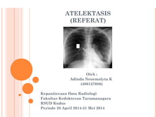 ATELEKTASIS
(REFERAT)
Oleh :
Adinda Nourmalyta K
(406127086)
Kepaniteraan Ilmu Radiologi
Fakultas Kedokteran Tarumanagara
RSUD Kudus
Periode 28 April 2014-31 Mei 2014

 