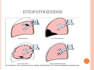 ETIOPATOGENESIS
 