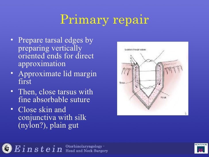 232b Coclia 97 98 Eyelid Reconstruction, Facial Reanimation