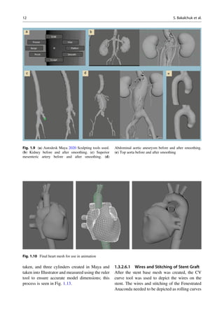 taken, and three cylinders created in Maya and
taken into Illustrator and measured using the ruler
tool to ensure accurate model dimensions; this
process is seen in Fig. 1.13.
1.3.2.6.1 Wires and Stitching of Stent Graft
After the stent base mesh was created, the CV
curve tool was used to depict the wires on the
stent. The wires and stitching of the Fenestrated
Anaconda needed to be depicted as rolling curves
Fig. 1.9 (a) Autodesk Maya 2020 Sculpting tools used.
(b) Kidney before and after smoothing. (c) Superior
mesenteric artery before and after smoothing. (d)
Abdominal aortic aneurysm before and after smoothing.
(e) Top aorta before and after smoothing
Fig. 1.10 Final heart mesh for use in animation
12 S. Bakalchuk et al.
 