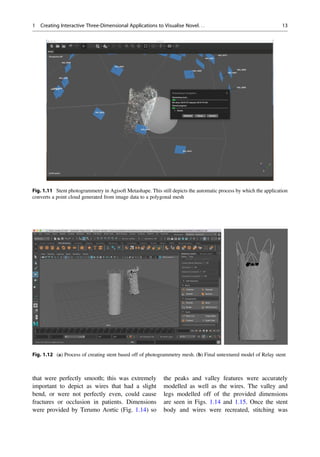 that were perfectly smooth; this was extremely
important to depict as wires that had a slight
bend, or were not perfectly even, could cause
fractures or occlusion in patients. Dimensions
were provided by Terumo Aortic (Fig. 1.14) so
the peaks and valley features were accurately
modelled as well as the wires. The valley and
legs modelled off of the provided dimensions
are seen in Figs. 1.14 and 1.15. Once the stent
body and wires were recreated, stitching was
Fig. 1.11 Stent photogrammetry in Agisoft Metashape. This still depicts the automatic process by which the application
converts a point cloud generated from image data to a polygonal mesh
Fig. 1.12 (a) Process of creating stent based off of photogrammetry mesh. (b) Final untextured model of Relay stent
1 Creating Interactive Three-Dimensional Applications to Visualise Novel. . . 13
 