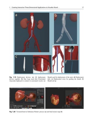 Fig. 1.19 Deployment devices. (a) All deployment
devices together. (b) Iliac Legs used after Fenestrated
Anaconda deployed to connect to associated vessels. (c)
Sheath used for deployment of the stent. (d) Deployment
tube. (e) Deployment wires for guiding the sheath. (f)
Sheath aid tip
Fig. 1.20 Textured heart in Substance Painter: process (a) and ﬁnal texture map (b)
1 Creating Interactive Three-Dimensional Applications to Visualise Novel. . . 17
 