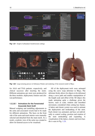 for AAA and TAA patients, respectively, and
clinical successes after inserting the stents.
Different animations per stent were produced for
the three modules: deployment, features and clin-
ical performance.
1.3.2.8.1 Animations for the Fenestrated
Anaconda Stent Graft
Manual sculpting and modelling adjustments to
the aorta and associated vessels had to be made
for different animations. The faces on the front
side of the aorta and renal arteries were manually
selected and detached from the main mesh. As a
result, a realistic view of the aorta was created to
allow for femoral access to be visualised.
All of the deployment tools were animated
using the curve warp deformer in Maya. The
deformer ﬁrstly allows for objects to be deformed
along a curve path and enables manipulation of
the length scale and offset of the 3D object; this
made animating quite a challenge given the
factors, such as scale, rotation and smoothed
movement, considered when setting key frames.
A lattice and cluster system was used to animate
the deployment and unsheathing of the stent.
Each cluster was animated, and keys set individ-
ually to control scaling, position and rotation of
the stent unsheathing and expanding. A
visualisation of the lattice, clusters and twist han-
dle is seen in Fig. 1.24.
Fig. 1.21 Graph of aiStandard Arnold texture settings
Fig. 1.22 Lung texturing process in Substance Painter and rendering of the textured model in Maya
18 S. Bakalchuk et al.
 