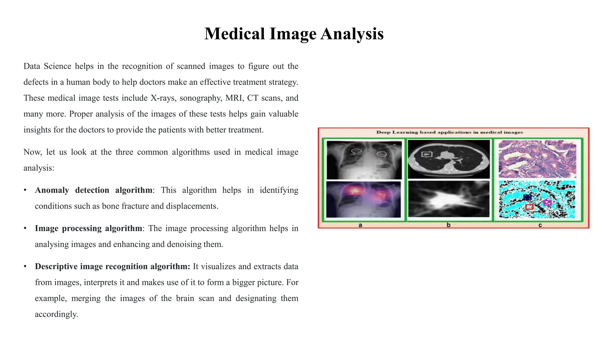 Medical Image Analysis
Data Science helps in the recognition of scanned images to figure out the
defects in a human body to help doctors make an effective treatment strategy.
These medical image tests include X-rays, sonography, MRI, CT scans, and
many more. Proper analysis of the images of these tests helps gain valuable
insights for the doctors to provide the patients with better treatment.
Now, let us look at the three common algorithms used in medical image
analysis:
• Anomaly detection algorithm: This algorithm helps in identifying
conditions such as bone fracture and displacements.
• Image processing algorithm: The image processing algorithm helps in
analysing images and enhancing and denoising them.
• Descriptive image recognition algorithm: It visualizes and extracts data
from images, interprets it and makes use of it to form a bigger picture. For
example, merging the images of the brain scan and designating them
accordingly.
 