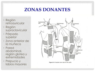 ZONAS DONANTES
• Región
retroauricular
• Región
supraclavicular
• Párpado
superior
• Zona anterior de
la muñeca
• Pared
abdominal,
región glútea y
extremidades
• Prepucio y
labios mayores
 