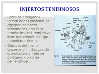 INJERTOS TENDINOSOS
• Fibras de colagenos
formas haces primarios, se
agrupan en haces
secundarios, con finas
trabéculas de t. conjuntivo
laxo: paratendón y luego
cobertura externa.
• Despues del injerto
aparece un t. fibroso y de
granulación, sintesis de
colágeno y uniones
peritendinosas.
 