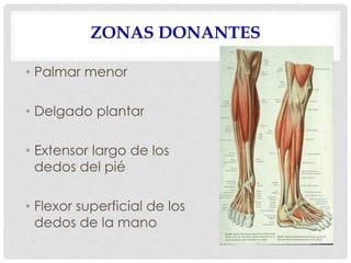 ZONAS DONANTES
• Palmar menor
• Delgado plantar
• Extensor largo de los
dedos del pié
• Flexor superficial de los
dedos de la mano
 