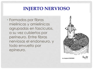 INJERTO NERVIOSO
• Formados por fibras
mielinicas y amielinicas
agrupadas en fasciculos,
a su vez cubiertos por
perineuro. Entre fibras
nerviosas el endoneuro, y
todo envuelto por
epineuro.
 