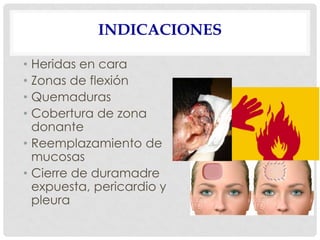 INDICACIONES
• Heridas en cara
• Zonas de flexión
• Quemaduras
• Cobertura de zona
donante
• Reemplazamiento de
mucosas
• Cierre de duramadre
expuesta, pericardio y
pleura
 