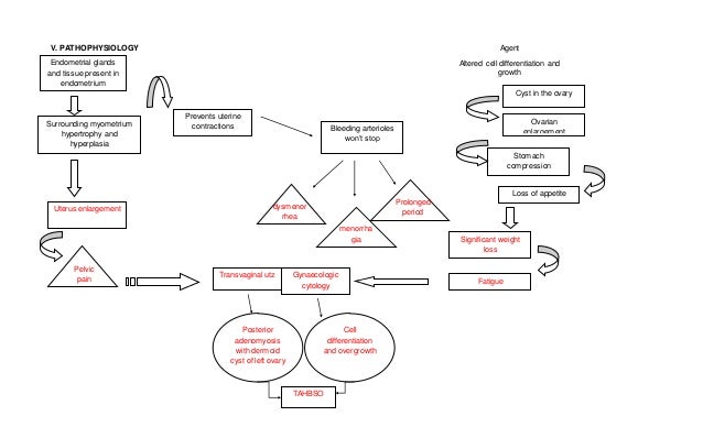 Pathophysiology of hysterectomy