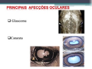 PRINCIPAIS AFECÇÕES OCULARES
 Glaucoma
Catarata
 