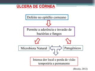 (Brooks, 2012)
ÚLCERA DE CÓRNEA
Defeito no epitélio corneano
Permite a aderência e invasão de
bactérias e fungos
Microbiota Natural
Intensa dor local e perda de visão
temporária a permanente
Patogênicos
 