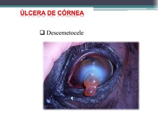 ÚLCERA DE CÓRNEA
 Descemetocele
 