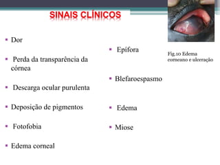  Dor
 Perda da transparência da
córnea
 Descarga ocular purulenta
 Deposição de pigmentos
 Fotofobia
 Edema corneal
 Epífora
 Blefaroespasmo
 Edema
 Miose
SINAIS CLÍNICOS
Fig.10 Edema
corneano e ulceração
 