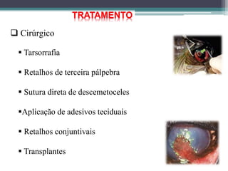 TRATAMENTO
 Cirúrgico
 Tarsorrafia
 Retalhos de terceira pálpebra
 Sutura direta de descemetoceles
Aplicação de adesivos teciduais
 Retalhos conjuntivais
 Transplantes
 