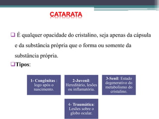  É qualquer opacidade do cristalino, seja apenas da cápsula
e da substância própria que o forma ou somente da
substância própria.
Tipos:
1- Congênitas :
logo após o
nascimento.
2-Juvenil:
Hereditário, lesões
ou inflamatória.
3-Senil: Estado
degenerativo do
metabolismo do
cristalino.
4- Traumática:
Lesões sobre o
globo ocular.
CATARATA
 