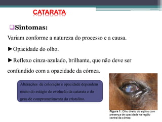 Sintomas:
Variam conforme a natureza do processo e a causa.
►Opacidade do olho.
►Reflexo cinza-azulado, brilhante, que não deve ser
confundido com a opacidade da córnea.
CATARATA
Alterações de coloração e opacidade dependem
muito do estágio de evolução da catarata e do
grau de comprometimento do cristalino.
 